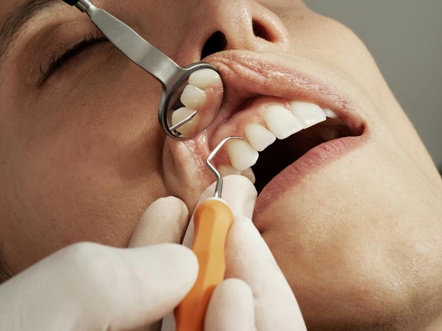 Dentist examining a patient's teeth